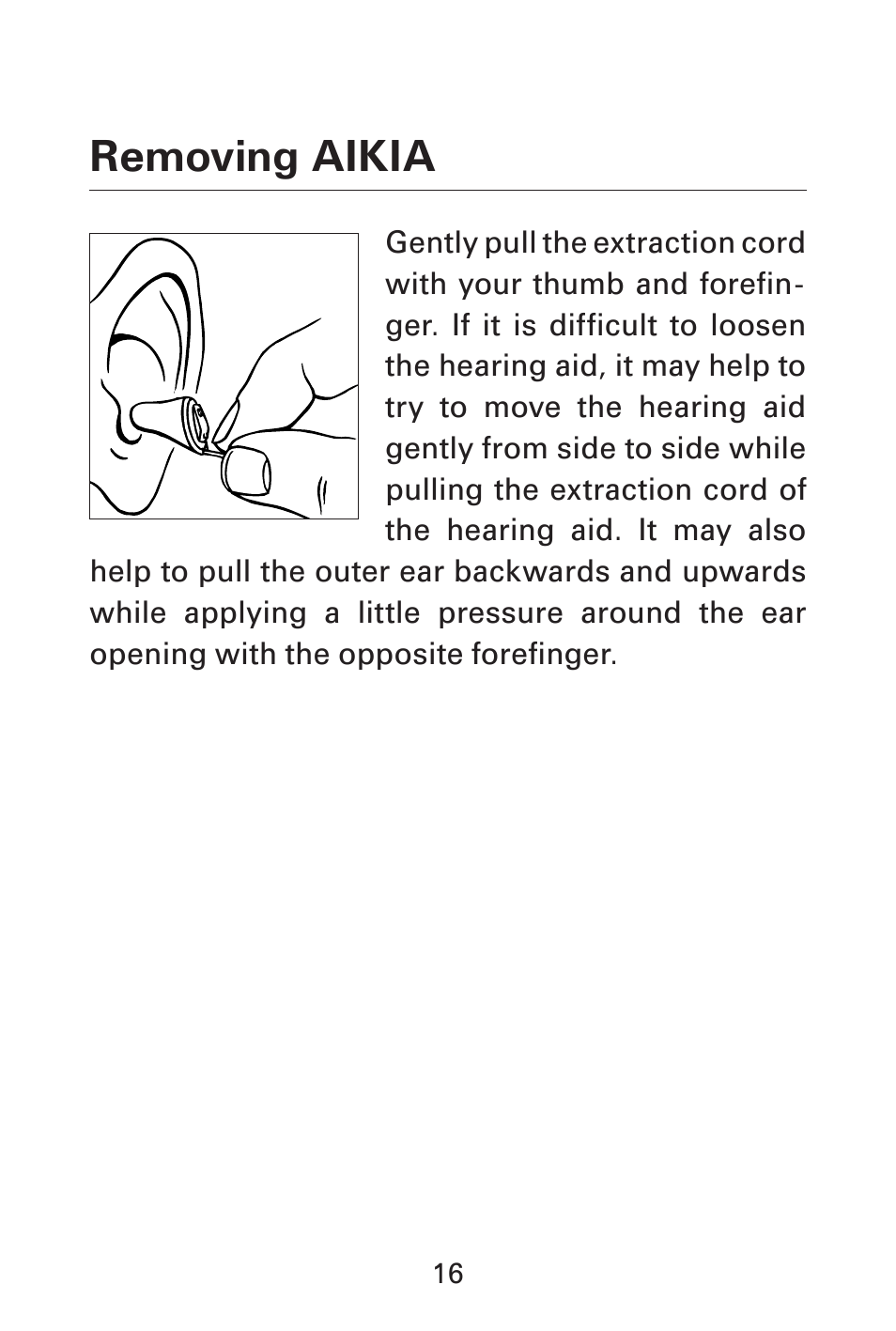 Removing aikia | Widex AK-CIC User Manual | Page 16 / 48