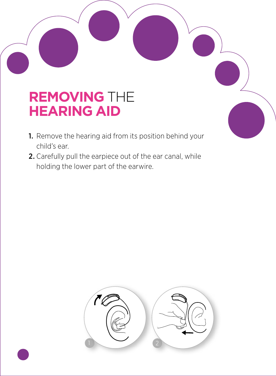 Removing the hearing aid | Widex BABY440 User Manual | Page 9 / 15