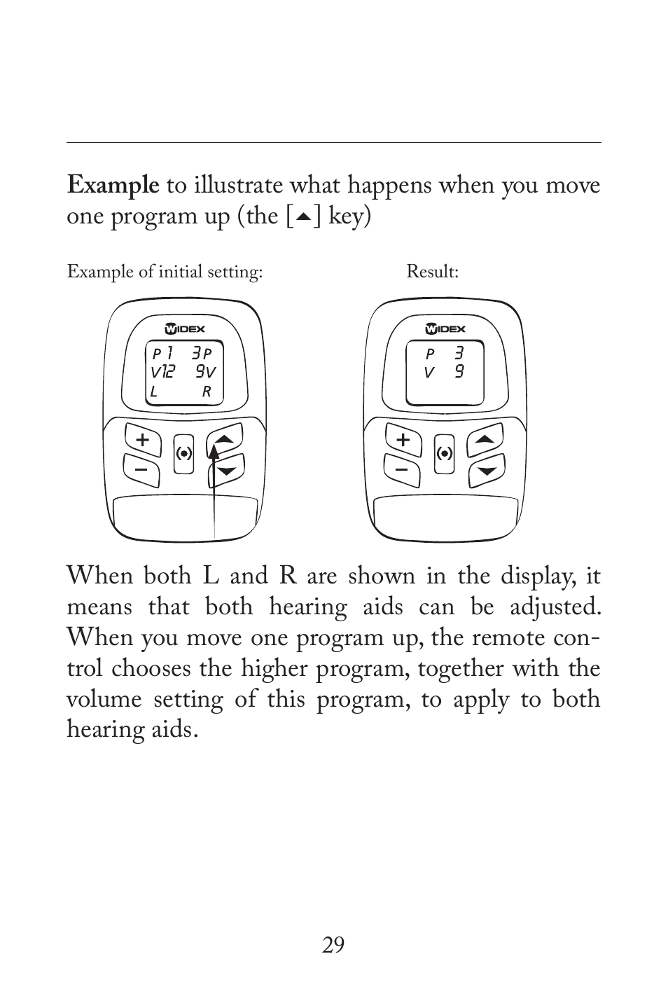 Key) | Widex RC3-2 User Manual | Page 29 / 44