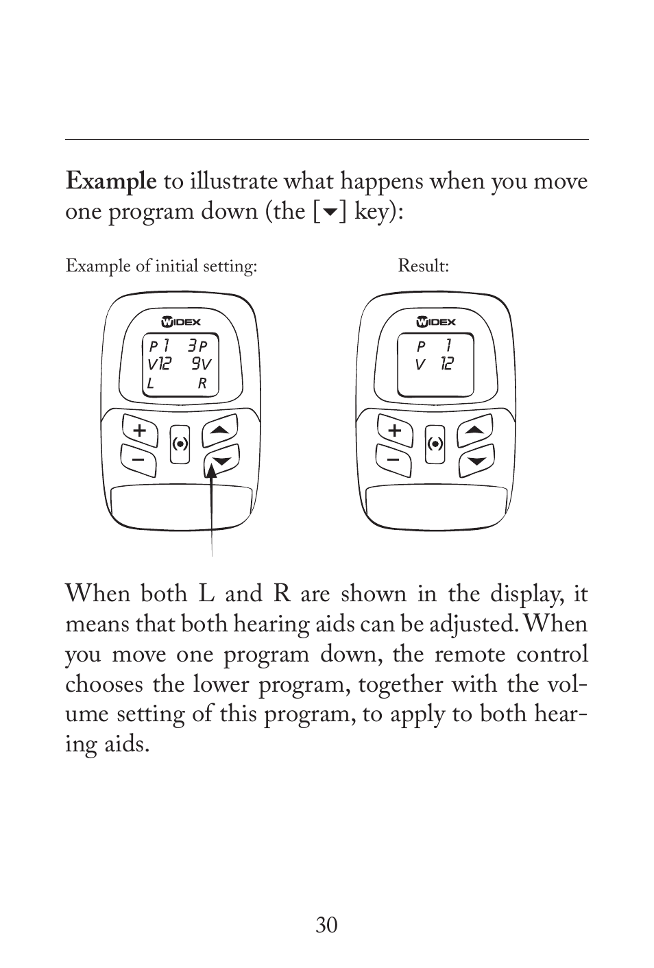 Key) | Widex RC3-2 User Manual | Page 30 / 44