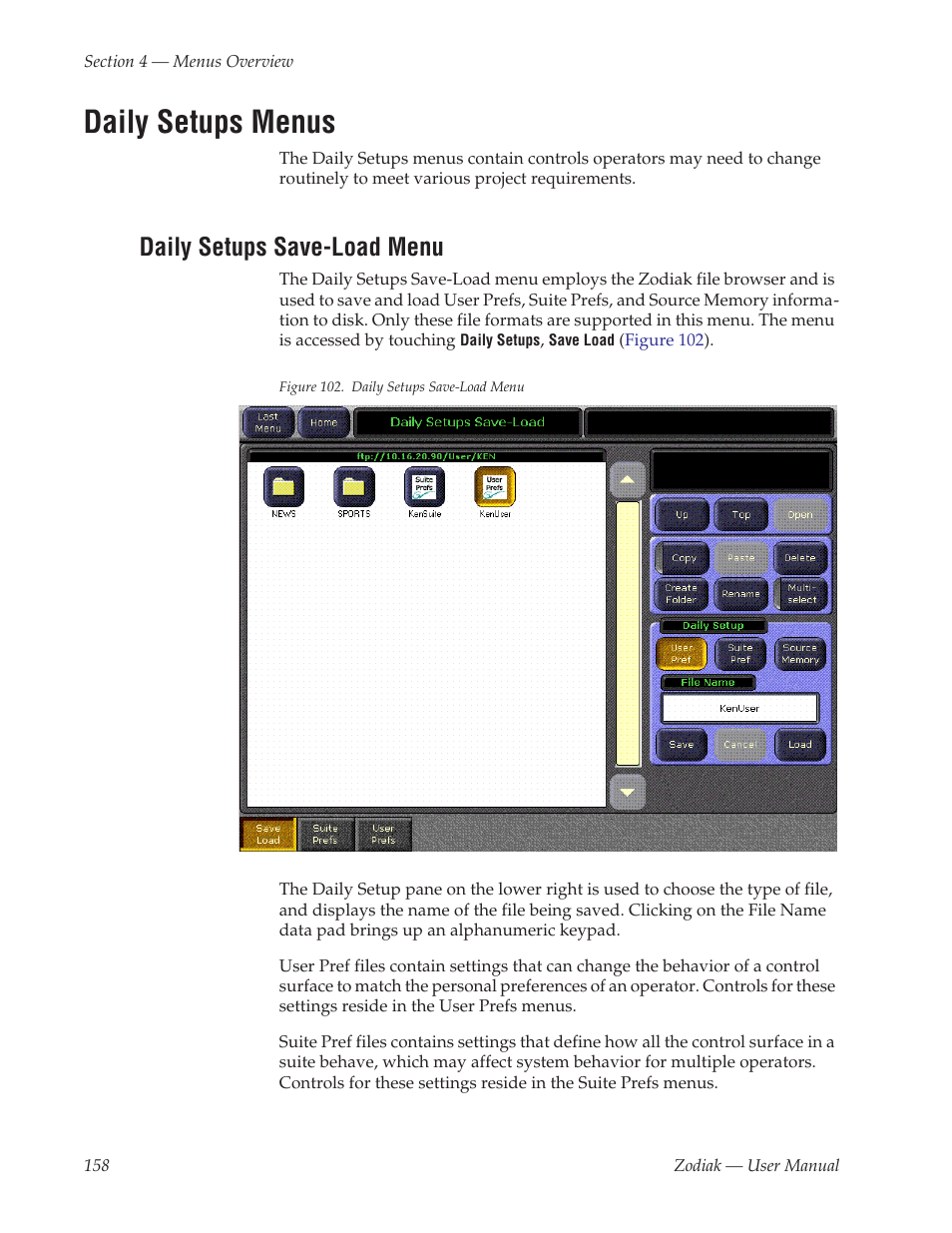 Daily setups menus, Daily setups save-load menu | Grass Valley Zodiak v.6.0 Mar 15 2006 User Manual | Page 158 / 494