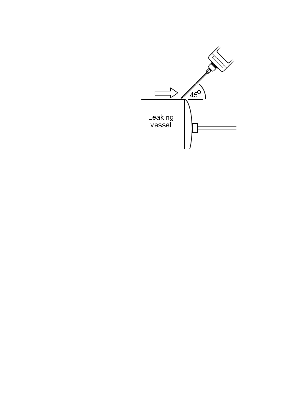 Detecting leaks, Overview | Ion Science GasCheck Tesla User Manual | Page 18 / 25