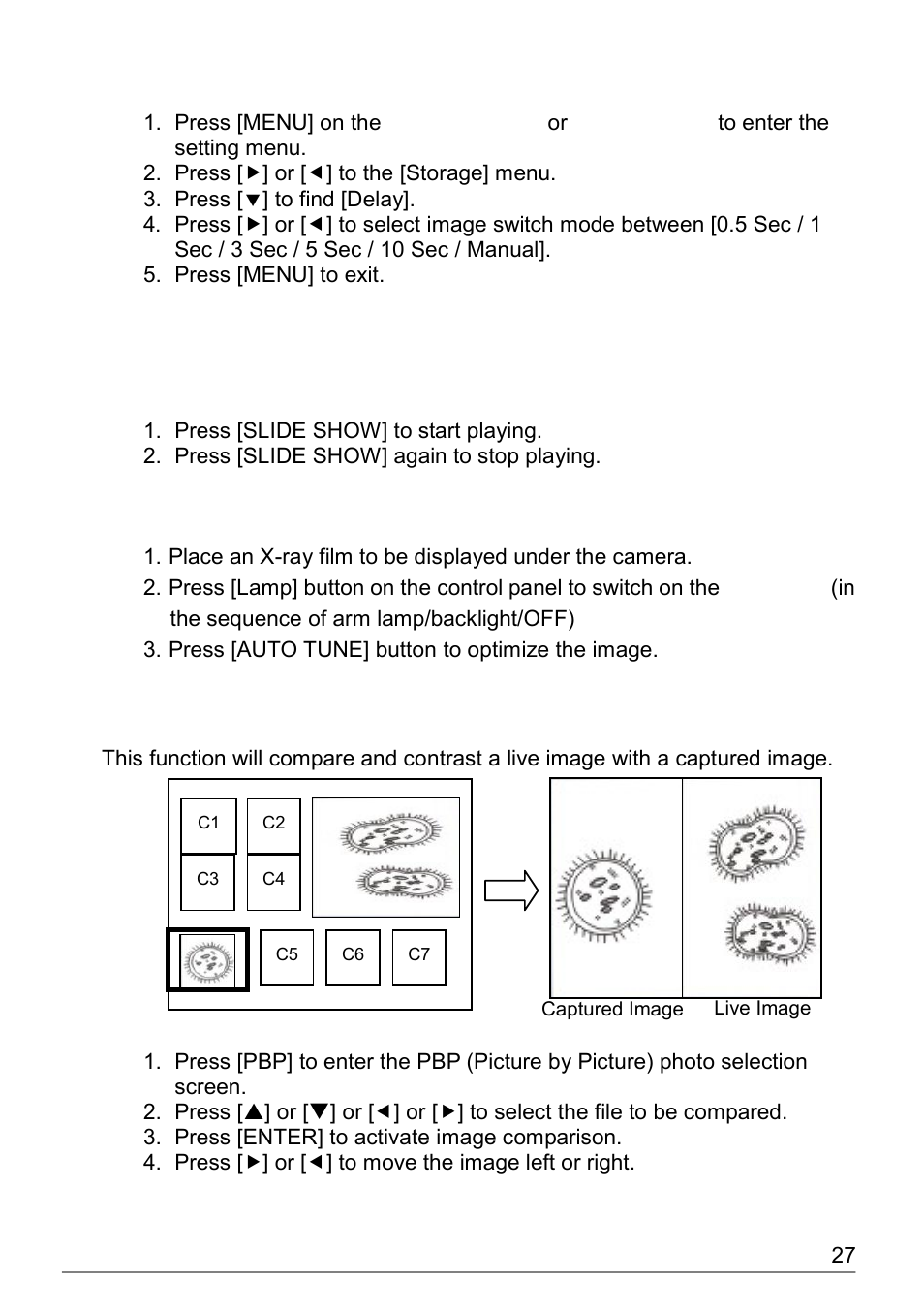 I would like to view the x-ray film, I would like to compare images (pbp), 16 i would like to view the x-ray film | 17 i would like to compare images (pbp) | Dukane Document Camera DVP508 User Manual | Page 28 / 45