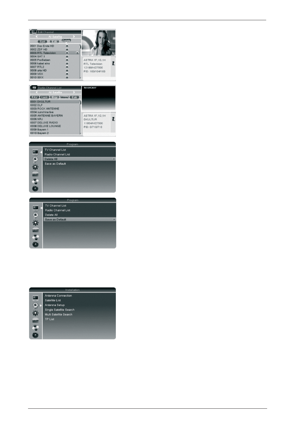 Installation | Silvercrest SSR 1080 A1 User Manual | Page 20 / 53