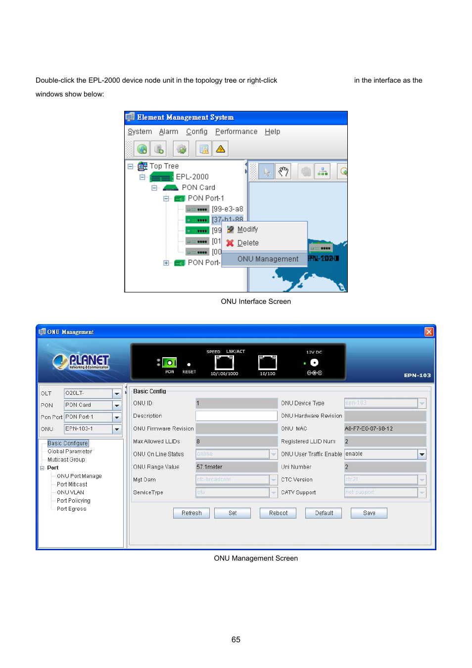 4 onu management | PLANET EPL-2000 User Manual | Page 65 / 81