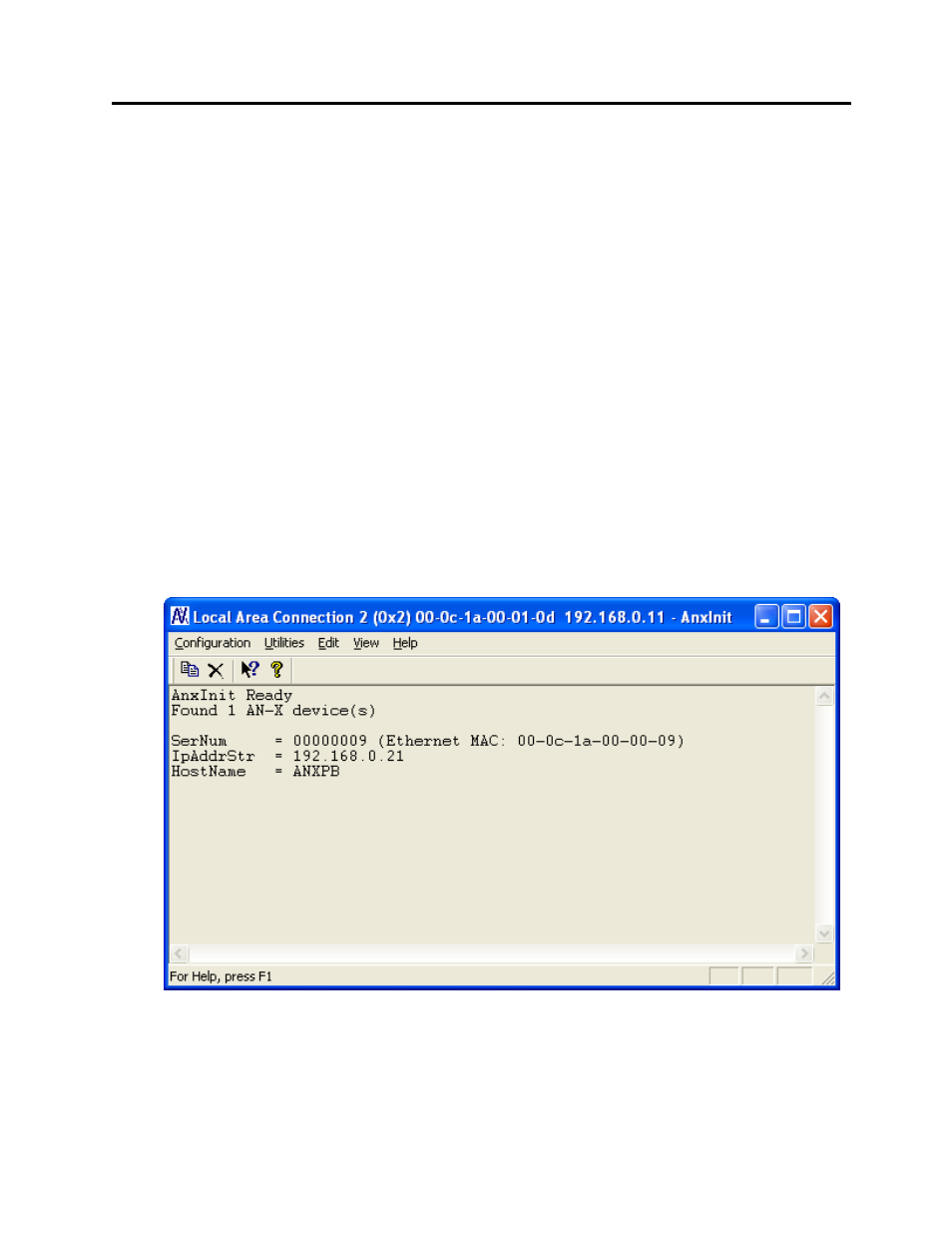 Ethernet configuration | ProSoft Technology AN-X-PB User Manual | Page 13 / 79