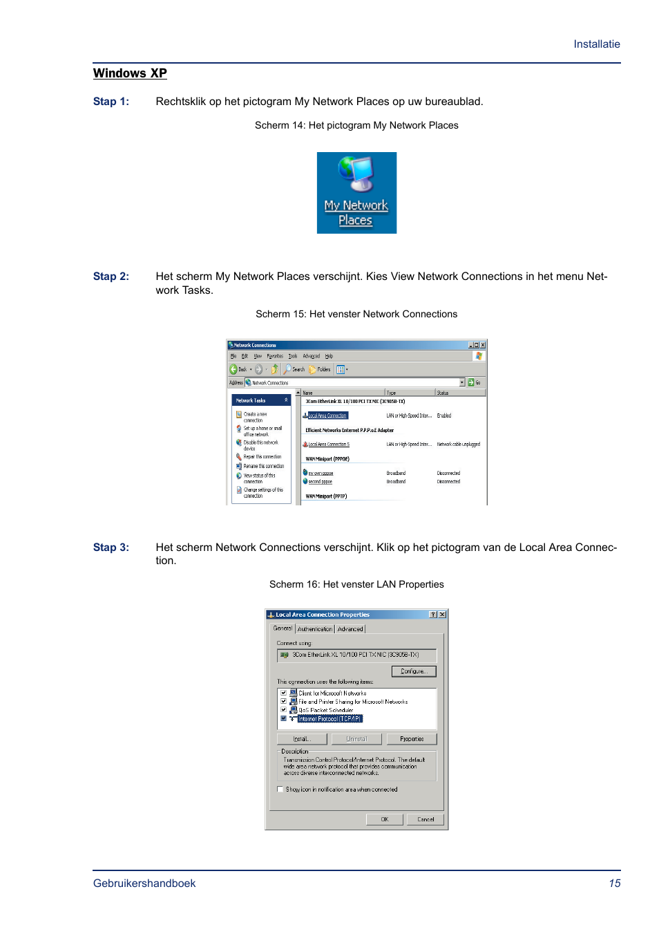 Windows xp | Efficient Networks SB5835 User Manual | Page 15 / 83