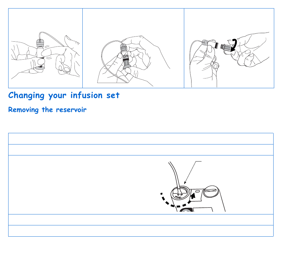 Changing your infusion set, Removing the reservoir | Energizer 715 User Manual | Page 68 / 188