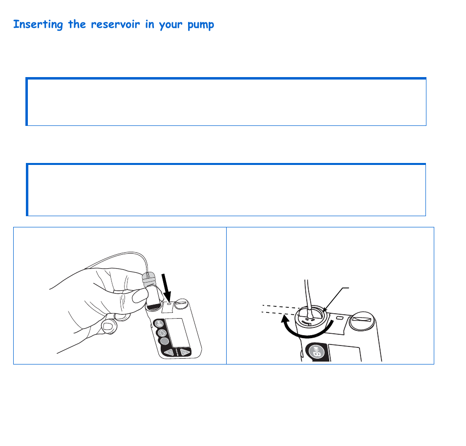 Inserting the reservoir in your pump, 48 chapter: 4 | Energizer 715 User Manual | Page 70 / 188