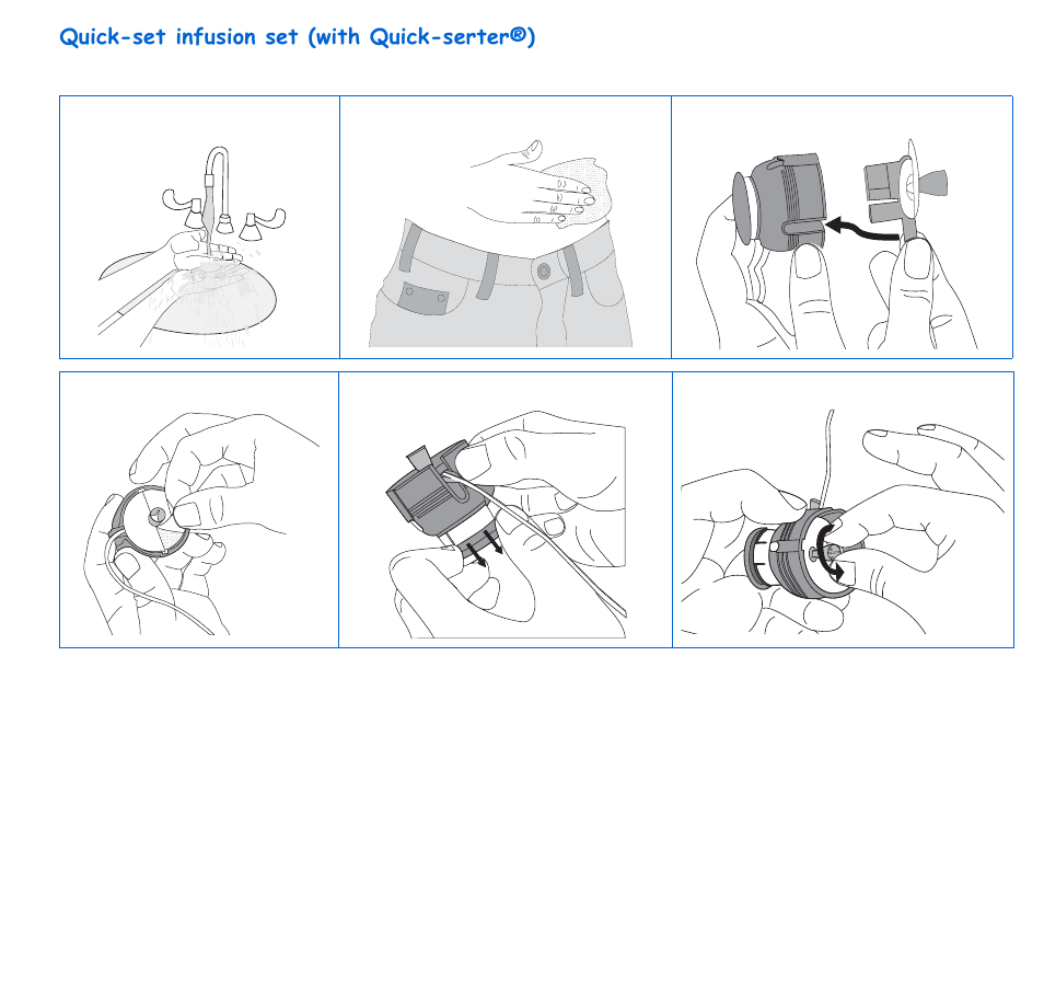 Quick-set infusion set (with quick-serter®) | Energizer 715 User Manual | Page 73 / 188