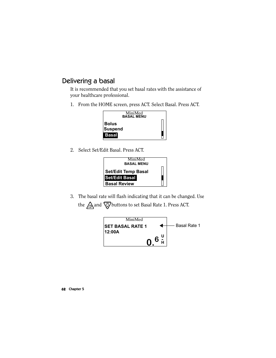 Delivering a basal | Energizer MMT-511 User Manual | Page 74 / 170