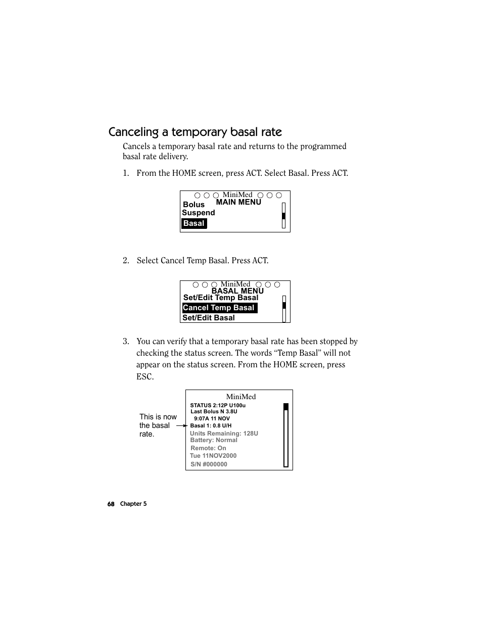 Canceling a temporary basal rate | Energizer MMT-511 User Manual | Page 80 / 170