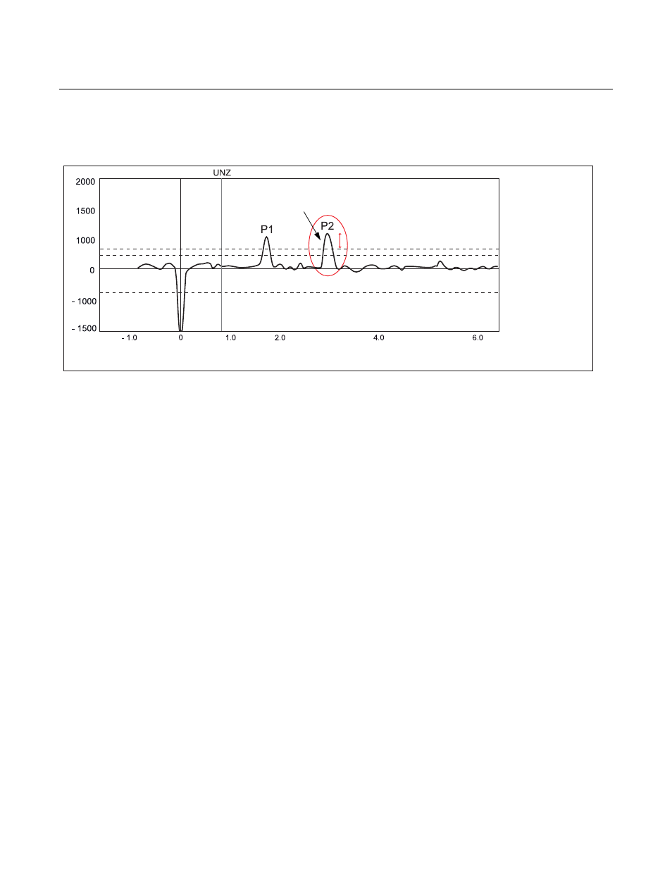 Signal quality metrics -9, Figure 7-7, Rosemount 5300 series | Reference manual, Signal quality metrics | Emerson Process Management ROSEMOUNT 5300 User Manual | Page 139 / 324